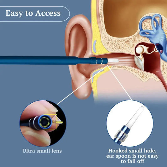 Endoscope pour Nettoyage Auriculaire Visuel