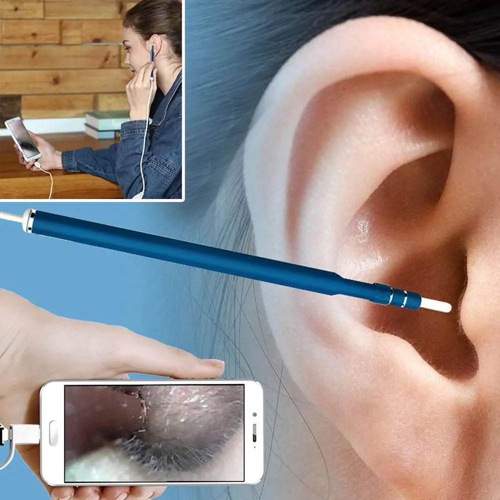 Endoscope pour Nettoyage Auriculaire Visuel